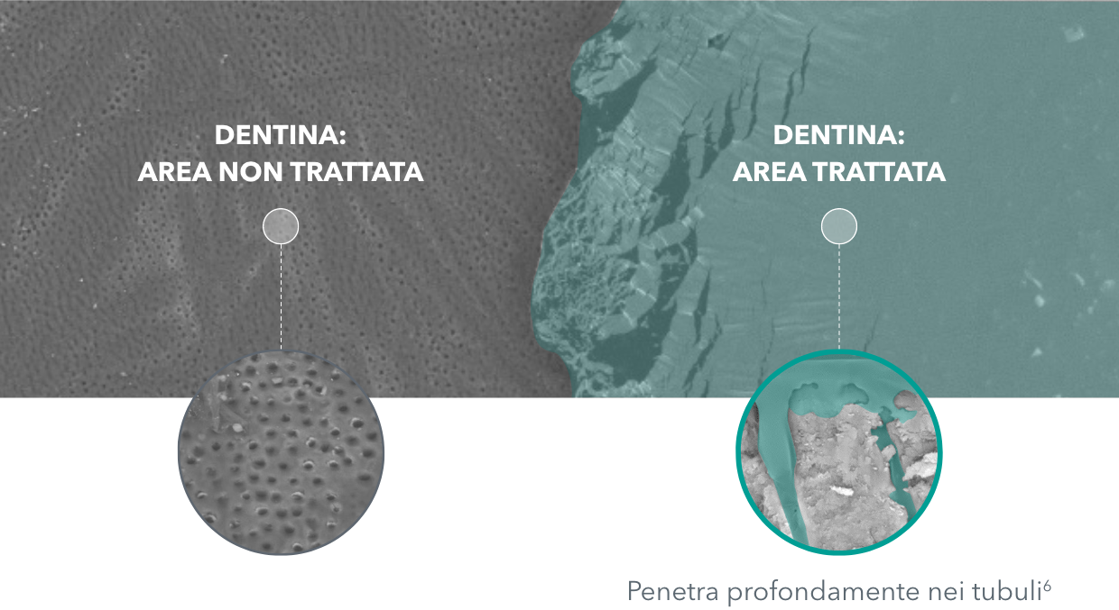 Immagine di Tubili Pre e Post vernice Immagine di Tubili Pre e Post vernice