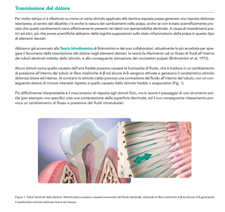 Illustrazione della Teoria Idrodinamica: i tubuli dentinali esposti causano movimento del fluido e dolore.